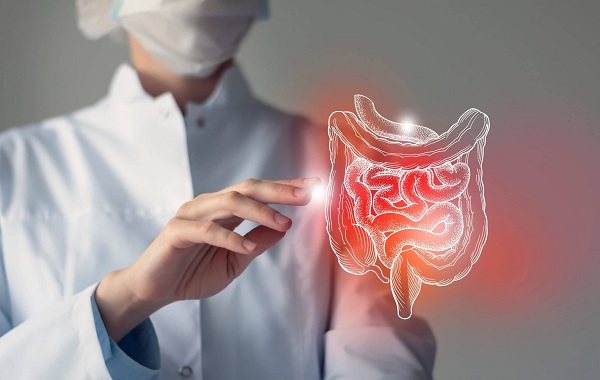 Viêm loét đại trực tràng có thể gây tử vong