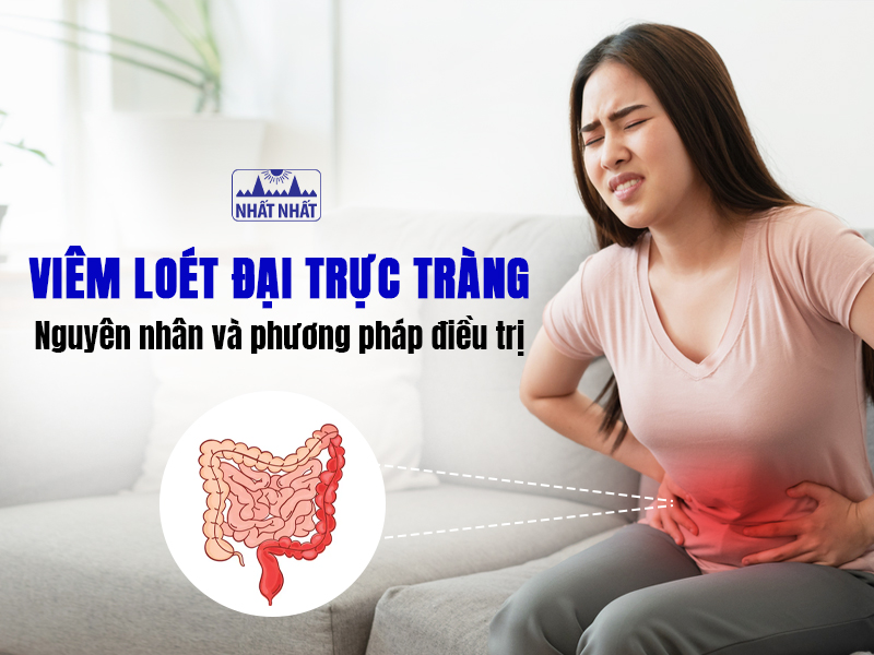 Viêm loét đại trực tràng gây nhiều biến chứng nguy hiểm