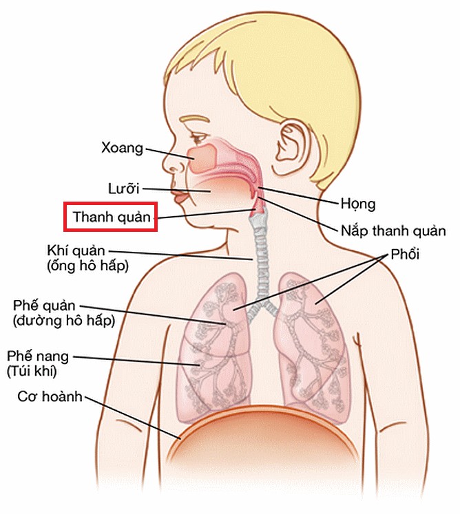 viêm dây thanh quản ở trẻ nhỏ