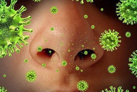 viêm xoang cấp tính là gì