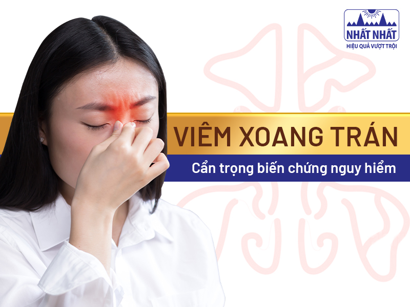 Viêm xoang trán là một trong những loại viêm xoang phổ biến