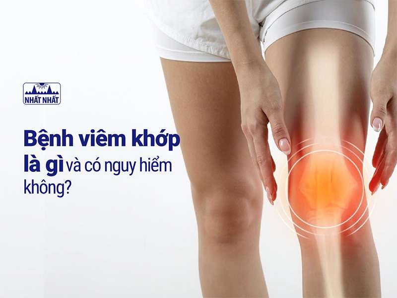 bệnh viêm khớp là gì
