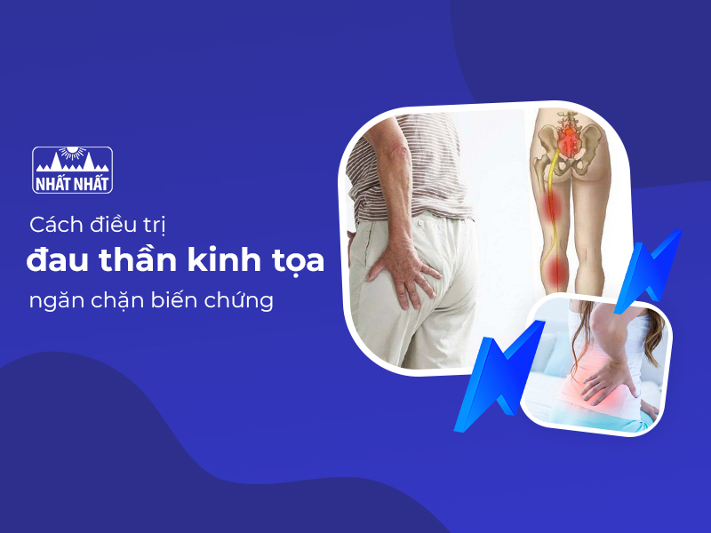 Đau thần kinh tọa