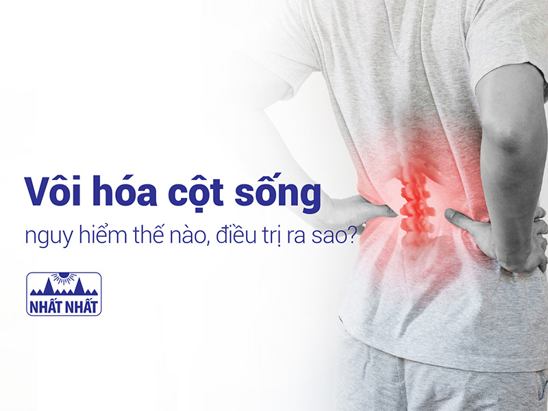 vôi hóa cột sống