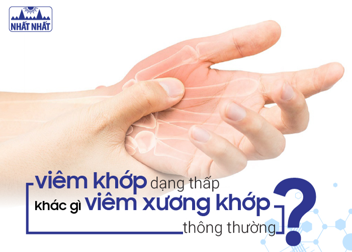 viêm khớp dạng thấp 