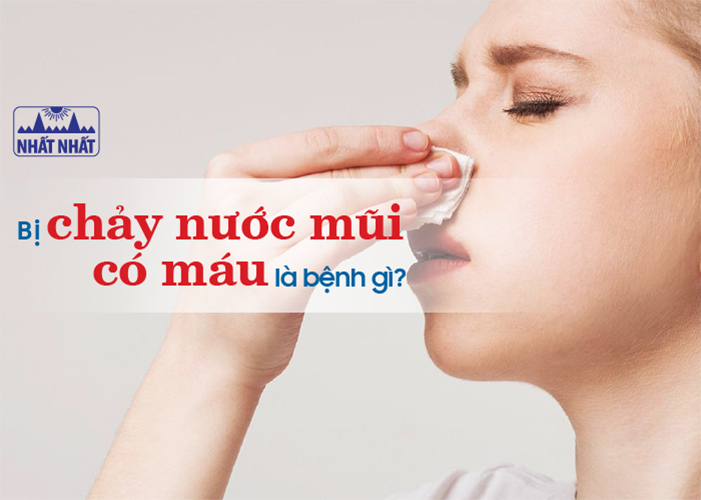 chảy nước mũi có máu