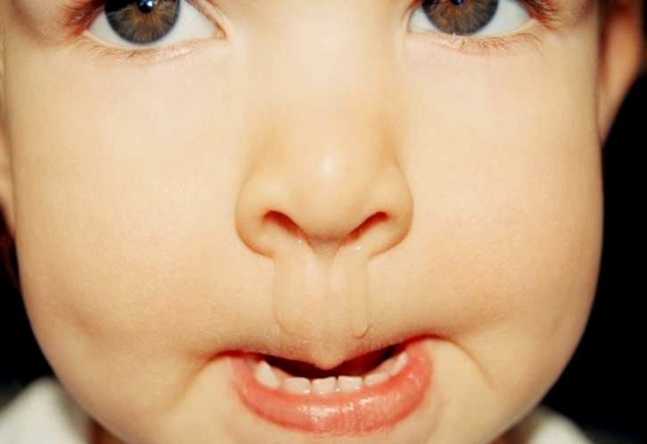 Màu nước mũi trong suốt tức là cơ thể đang khoẻ mạnh