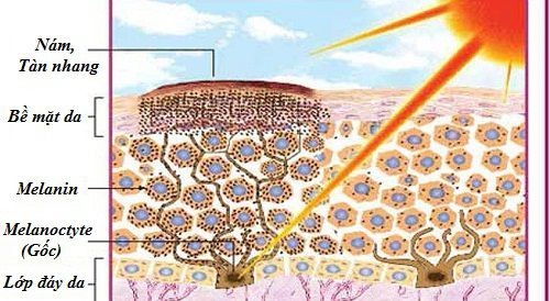 Tác động của tia UV đến làn da