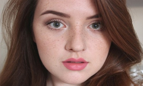 Tàn nhang là các điểm tròn, màu be, màu nâu trên da