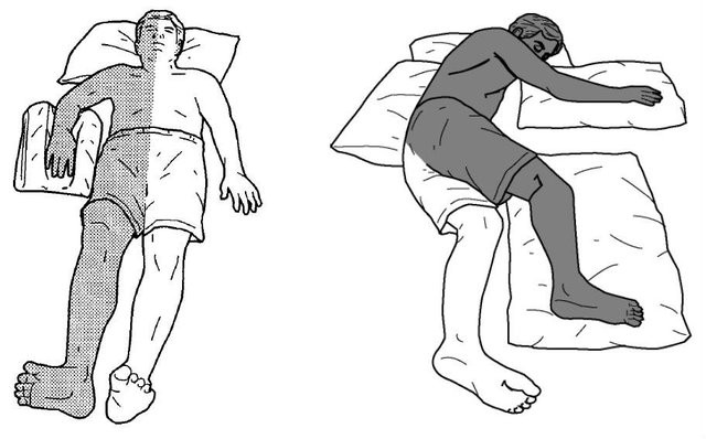 Tư thế nằm cho bệnh nhân sau đột quỵ bị liệt nửa người