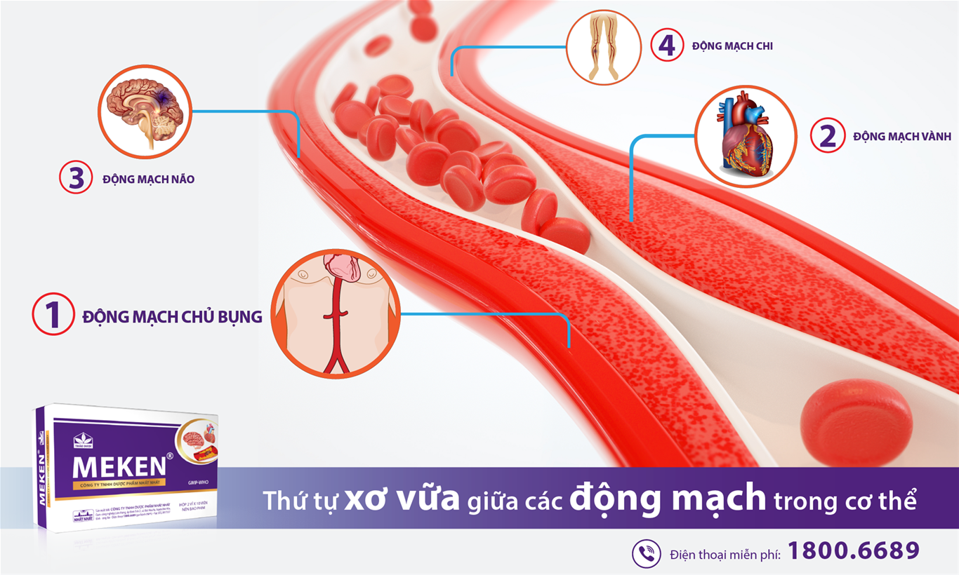Ảnh: Thứ tự xơ vữa giữa các động mạch trong cơ thể
