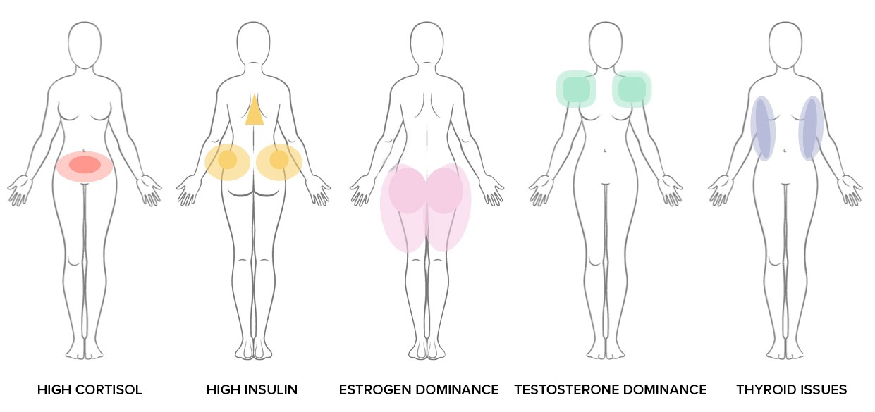 Mỡ phân bố không đều trên cơ thể